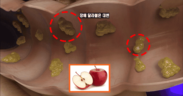 사과를 ‘이렇게’ 먹었더니 장 속 달라붙은 대변에 싹~ 사라졌다!