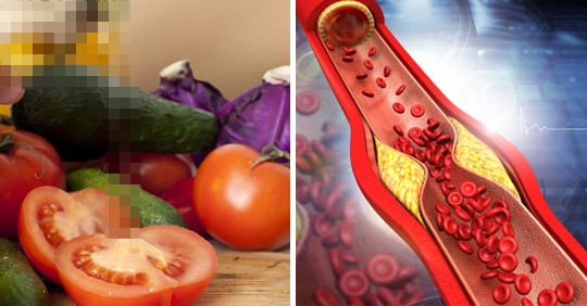 토마토와 ‘이것’을 함께 먹으면 막혀버린 혈관 뻥 뚫어주고 심혈관계질환이 60% 예방됩니다.