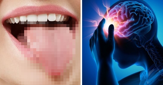 “혀 상태가 이렇다면 당장 병원에 가야 합니다” 혀가 보내는 건강 적신호 3가지!