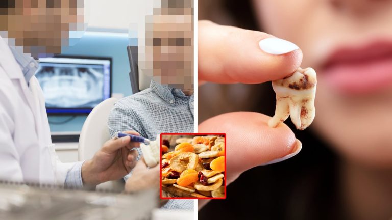 “이것만은 먹지 마세요!” 치과의사들은 잘 안먹는 ‘치아를 손상시키는 음식’ 4가지