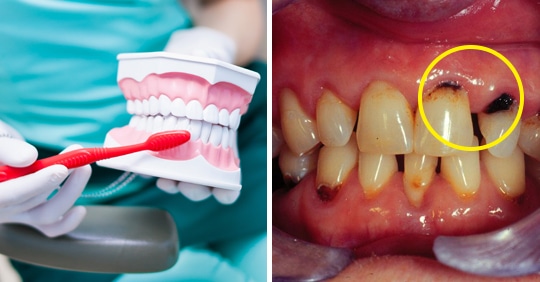 “충치치료 비용 굳었다!” 현직 치과의사가 공개한 ‘충치’ 절대 안 생긴다는 양치질 방법