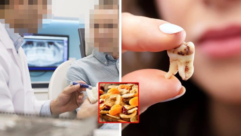 “이것만은 먹지 마세요!” 치과의사들은 잘 안먹는 ‘치아를 손상시키는 음식’ 4가지
