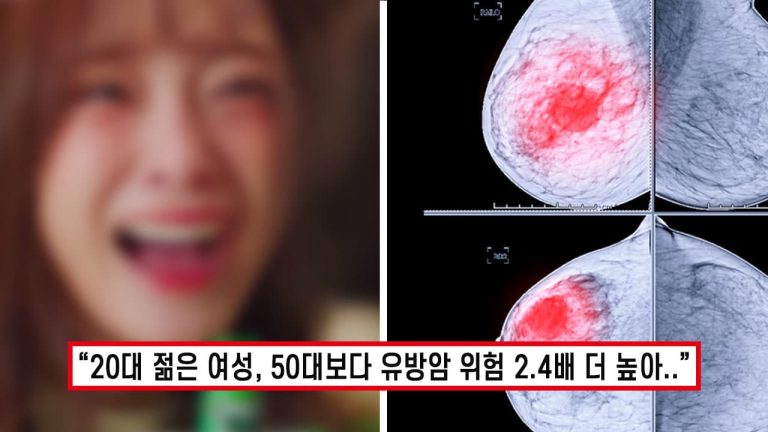 “오히려 젊으니깐 더 잘 걸립니다” 한국인 여성 80%가 모르는 유방암 발생률 높이는 뜻밖의 습관 5가지