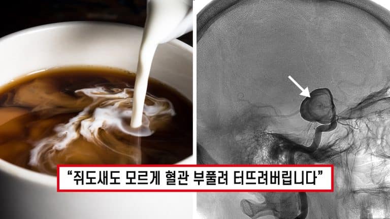 “먹지 마, 똥이야..” 맛 좋다고 커피에 넣어 먹었다가 ‘피떡’ 유발해 혈관 터뜨린다는 최악의 재료